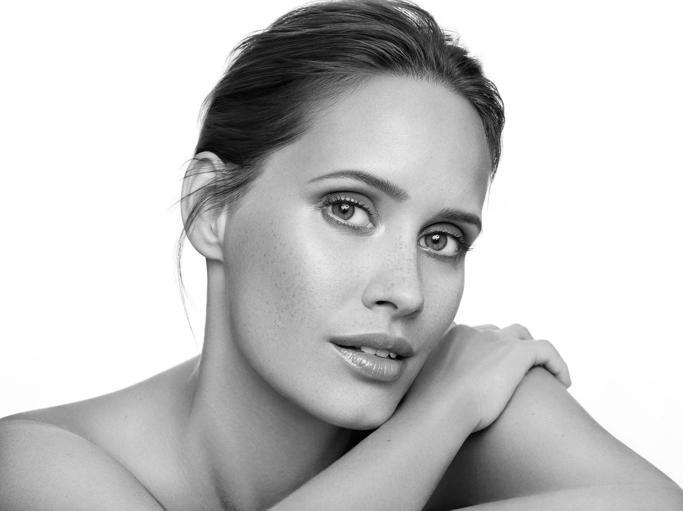 Microneedling Düsseldorf – Dr. medic Ancuta Hutuleac